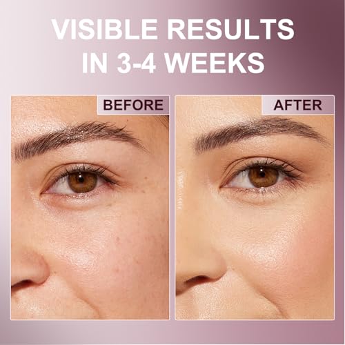 Retinol & Caffeine Eye Balm Stick ? Anti-Aging Wrinkle Core Stick for Eyes, Face & Neck, Reduces Wrinkles & Dark Circles, Hydrating & Firming Under Eye Cream with Niacinamide, Travel-Friendly 0.35 oz