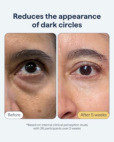 Dark Circles Eye Cream with Caffeine & Kojic Acid