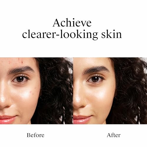 Neutrogena Rapid Clear Acne Spot Treatment Gel 10% Benzoyl Peroxide