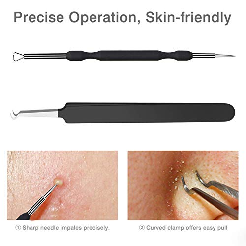 JPNK Blackhead Remover Tool Kit - 6 Pcs Stainless Steel Acne Extractor