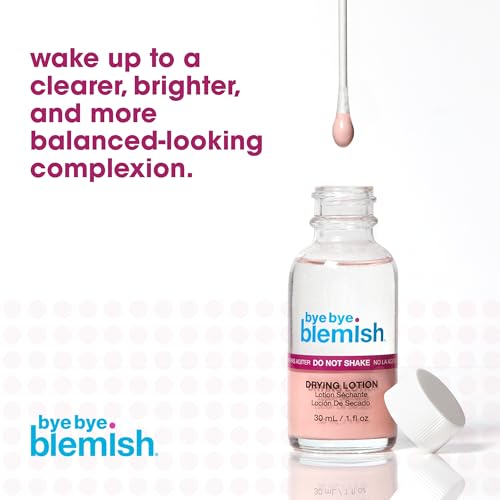 Bye Bye Blemish Acne Drying Lotion, Reduce Pimples Overnight 1oz, 1-Pack