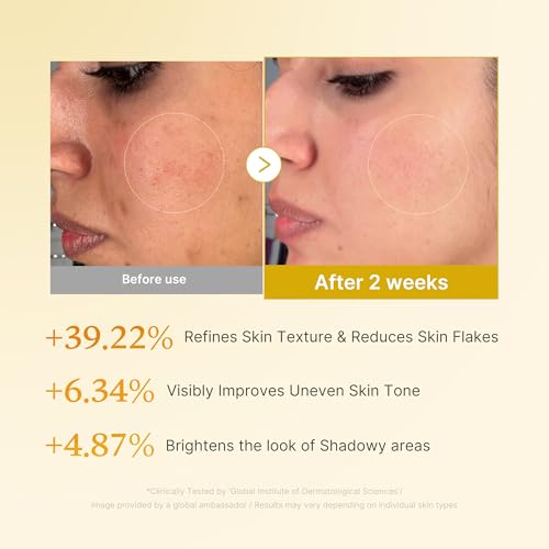 medicube Kojic Acid Turmeric Toner for Face & Body | 8.45 fl.oz