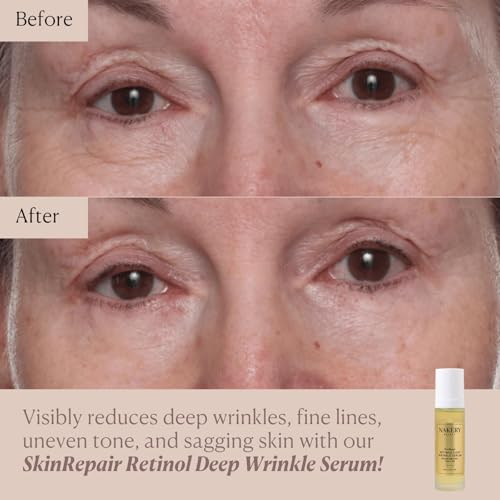 Nakery SkinRepair Retinol Deep Wrinkle Serum (2.02 Fl Oz), Anti Aging Face Serum with Encapsulated Retinol, NAD+ Complex, Ceramide NP, Hydrating Firming Skin Treatment for Fine Lines