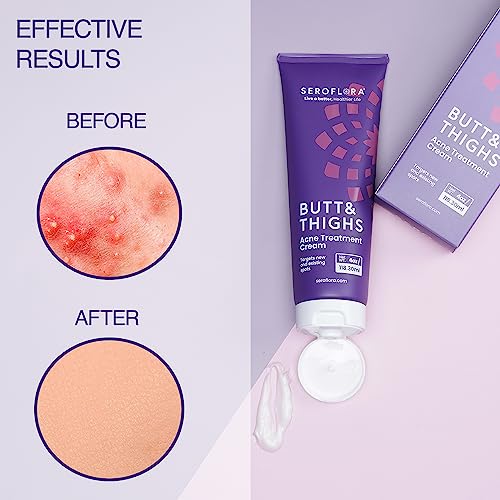 Butt Acne Cream & Razor Bump Serum ? Helps Reduce the Look of Ingrown Hairs, Bumps & Redness ? Post-Shave & Waxing Skin Comfort - Bundle