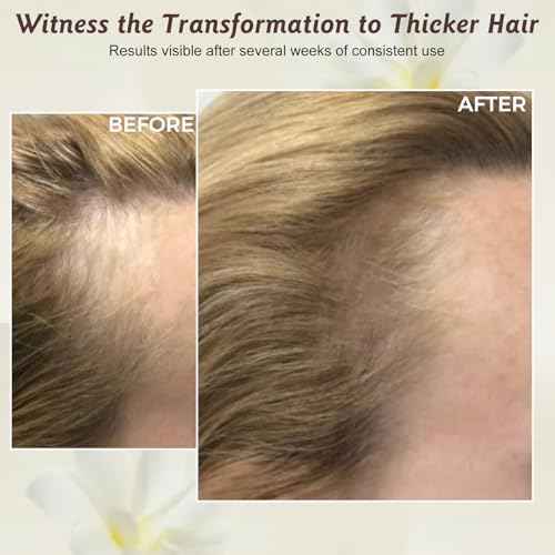 100% Natural Batana Oil for Hair Growth & Repair - Nourishes Scalp, Strengthens Hair, Reduces Breakage Split Ends, For Thicker Looking Hair - 1.76 fl oz