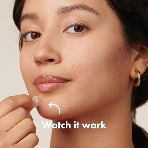 Mighty Patch Original Hydrocolloid Acne Patches, 75 Count
