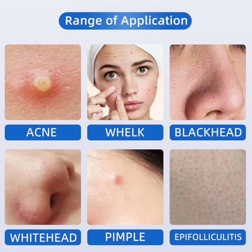 10 Pack of Disposable Sterile Acne Remover Tools Safe Pimple Popper Tool Aseptic Blackhead Remover Tools Sanitary Comedone Extractor Tool Pimple Extractor Tool