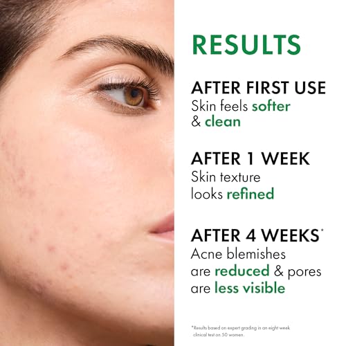 VICHY Normaderm Acne Control Daily Moisturizer, Oil Free Acne Moisturizer For Face, Max Strength 2% Salicylic Acid + Hyaluronic Acid + Vitamin C, Targets Blackheads, Blemishes & Enlarged Pores