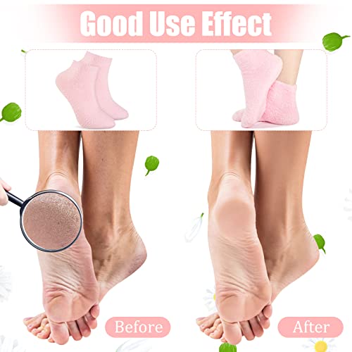 3 Pairs Aloe Infused Gel Moisturizing Spa Socks for Dry Cracked Feet