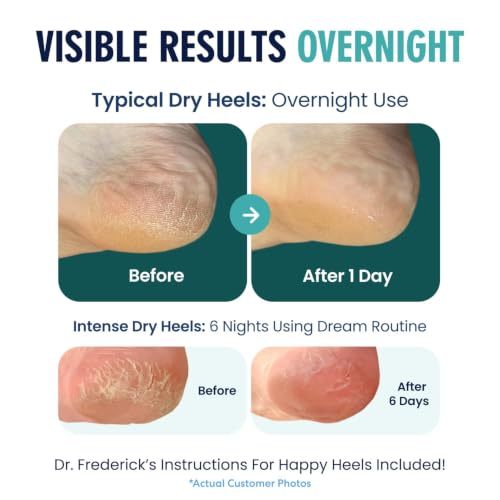 Dr. Frederick's Moisturizing Heel Socks, 2 Pairs | Gel-Infused Dry Heel Care