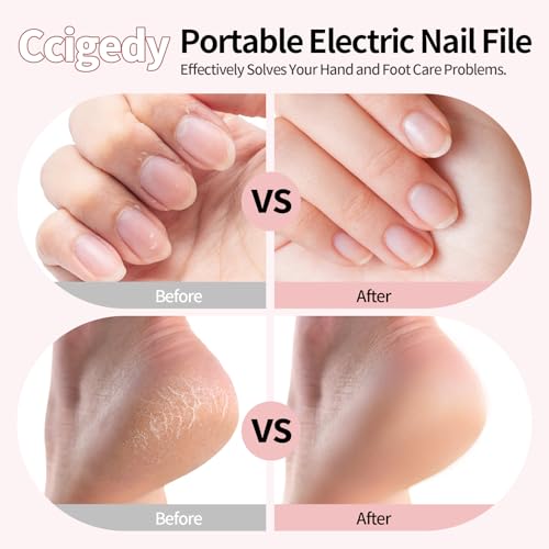 Cordless Electric Toenail Grinder with LED Light - 15 Speeds & USB-C Rechargeable