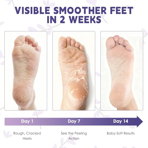Foot Peeling Mask 5 Pack – Exfoliator for Soft, Smooth Feet