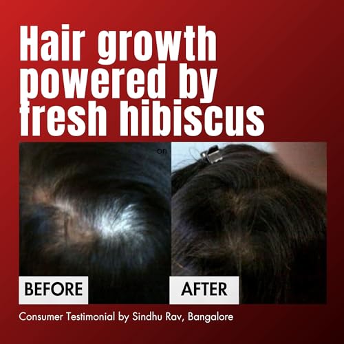 HM Love Scalp & Hair Oil, Promotes Hair Growth, Reduces Hair Fall, Scalp care, Anti Frizz, Real Hibiscus Flowers, Coconut Milk Oil, Natural, No Mineral Oil, Chemical-Free, 100mL