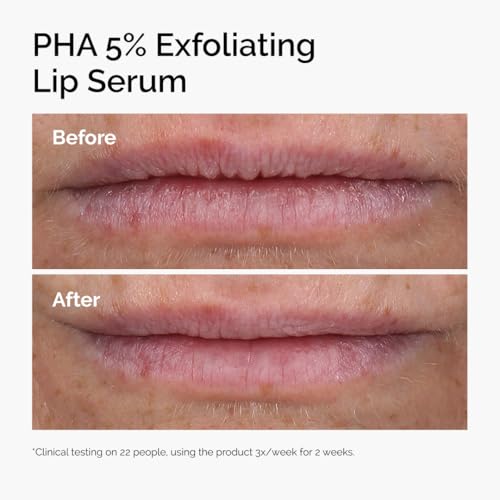 The Ordinary PHA 5% Lip Exfoliating Serum - Hydrating Overnight Lip Treatment