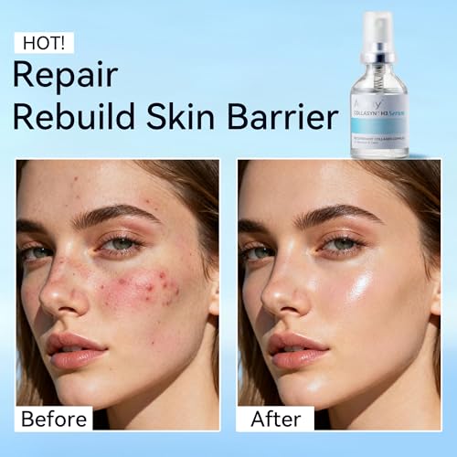 Recombinant Collagen Face Serum - Barrier Repair Serum with Panthenol Centella Licorice Complex for Hydrating Soothing Strengthening for Women & Men for Sensitive Redness-Prone Skin V2