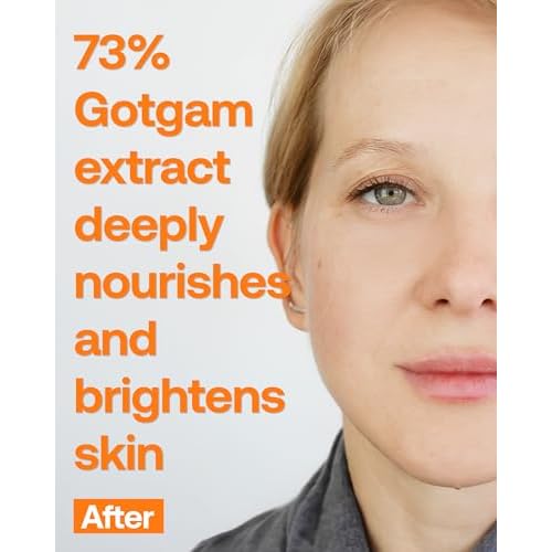Mela-fade Infused Gotgam Toning Serum, Korean Natural Facial Serum With Vitamin C, Hydrating and Soothing for Dark Spots, Sensitive Skin, Highly-Concentrated Korean Skin Care, 1.52 Fl Oz
