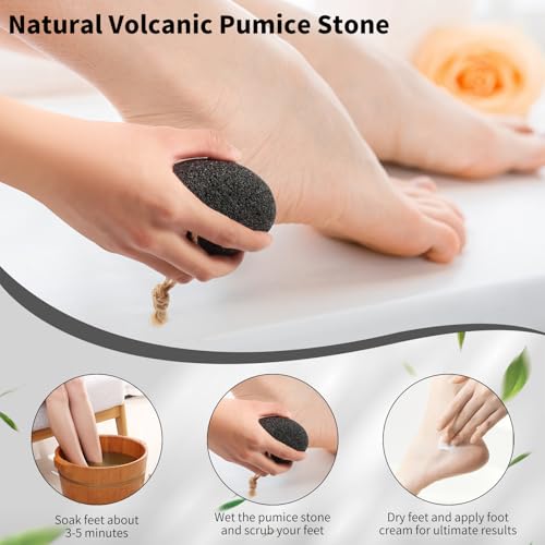 ÖkoStamm 4-Piece Natural Volcanic Pumice Stone Set for Feet Callus Removal