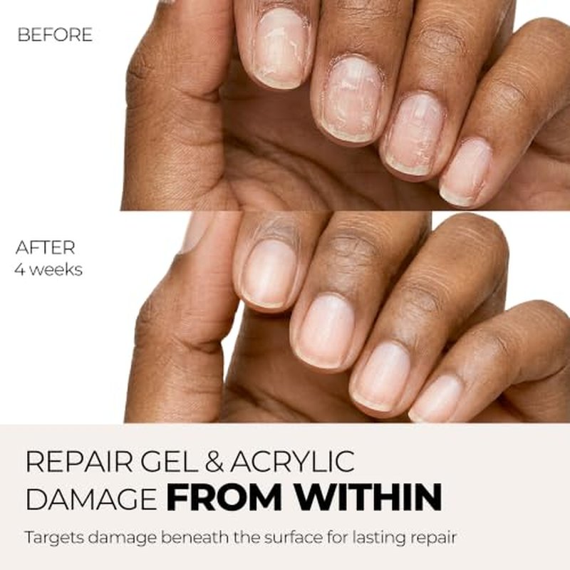 Nail Recovery Treatment for Gel & Acrylic Damage | Keratin Peptides