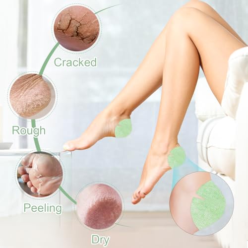 TEAWOO Aloe Vera Cracked Heel Patches - Heel Repair & Moisturizing Bandages