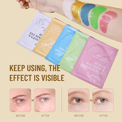 Yeokoe Under Eye Patches for Dark Circles & Puffy Eyes, 20 Pairs