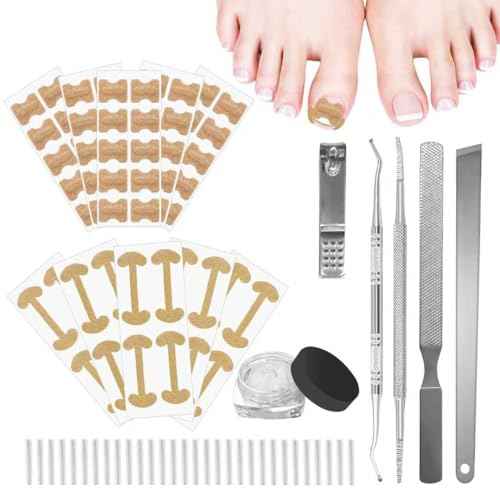 Ingrown Toenail Corrector Set with Correction Strips, Professional Ingrown Toenails Pedicure Tool Set, Painless File and Lifter Pedicure Tools Pedicure Tools,Ingrown Nail Tool for Women Man(1 Count)