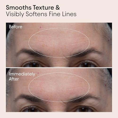 ALPYN Double Polishing Peel & Brightening Face Mask | Visibly Smooth & Brighten Skin While Refining the Look of Pores | 1.7 oz / 50 ml