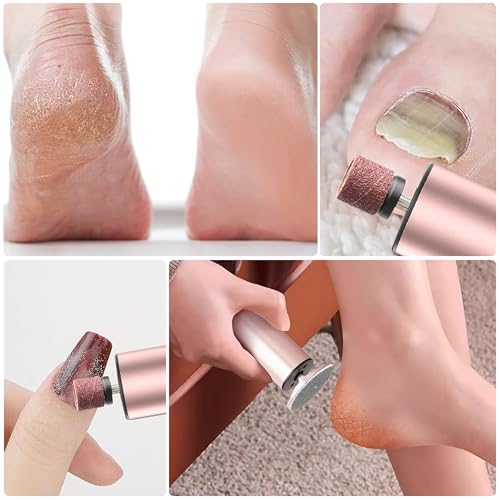 Electric Foot Callus Remover - Rechargeable Pedicure Tool