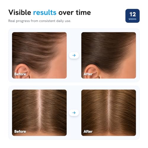 Hair Growth Serum Roll-On for Men & Women - 25ml