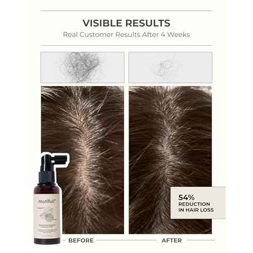 Motifull Hair Boosting Ampoule Tonic | Hair Growth Treatment for Hair Thinning & Hair Regrowth | Lightweight Scalp Serum for Women & Men | Scalp Treatment for Hair Growth (1.69)
