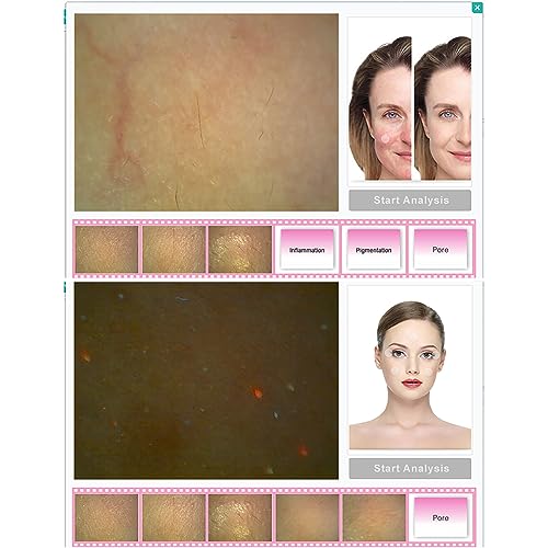 Skin Analyzer with 9 Reports | Facial Analysis Detector for Beauty Salons