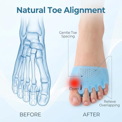 Silicone Toe Separators for Women & Men (8-Pack)