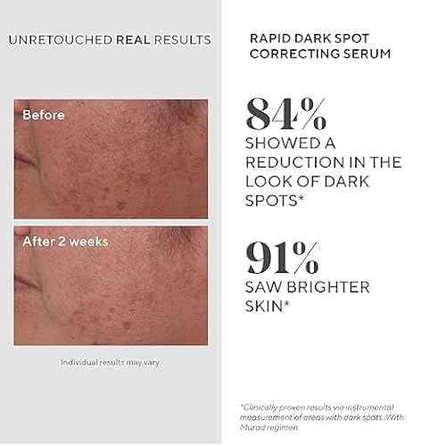 Murad Rapid Dark Spot Correcting Serum - Advanced Anti-Aging Formula with Patented Resorcinol Technology, Tranexamic and Glycolic Acids for Hyperpigmentation, Dark Spots and Dull Skin - 1 Fl Oz