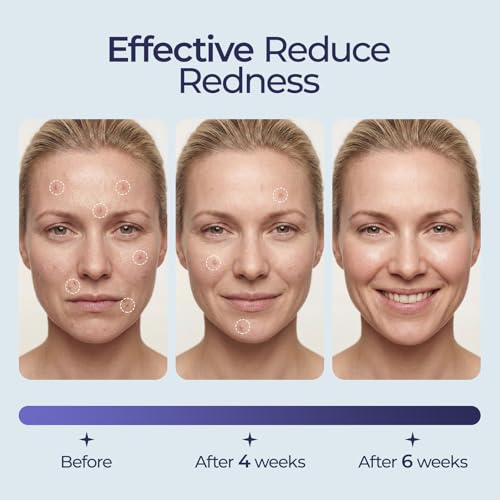 ECOLOOK Disposable Face Towel XL-60 Count Upgraded Thick Facial Towels, Ultra Soft Clean Face Towels Disposable, 10"x12" & 90 GSM, Ideal for Sensitive Skin?-1 PACK