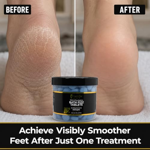 FootSpa Professional Callus Remover Foot Soak - Citric Acid Exfoliant, 42 oz