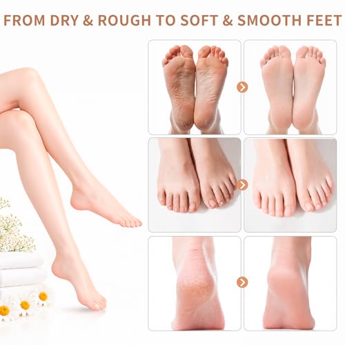 QUNGCO Moisturizing Foot Mask 20-Pack - Hydrating Socks for Dry Cracked Feet