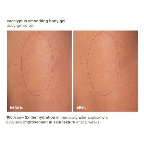MALIN+GOETZ Eucalyptus Smoothing Body Gel | Restorative Gel-to-Water Serum with Magnesium PCA, Urea + Phytic Acid | Improves Texture, Smoothness + Barrier Function | Vegan + Cruelty-Free (7.5 Fl Oz.)