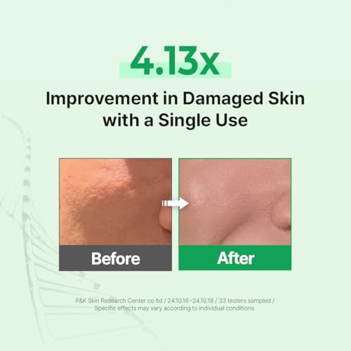 Zipiderm EGF Deep Cleansing Foam ? Korean Gentle Facial Cleanser with EGF for Sensitive & Acne-Prone Skin, Double Cleansing K-Beauty Foam that Supports Skin Barrier & Smooth Texture, 4.05 fl oz
