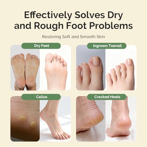 MelodySusie Tea Tree Oil Foot Soak with Sea Salt - 16 oz Pedicure Care