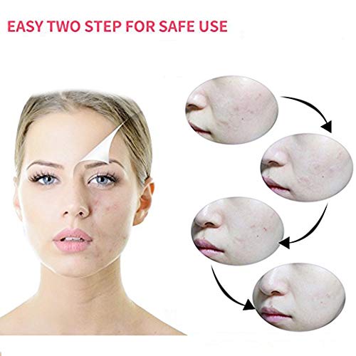 AGRCARE Acne Pimple Patch , Hydrocolloid Absorbing Patch Clear Acne Stickers (4 Sheets/80Patchs)