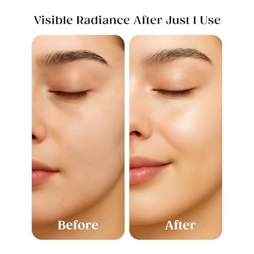 Kaplan MD Clarifying Toner ? Hydrating Face Mist with Hyaluronic Acid, Rosewater Face Mist Hydrating Spray & Witch Hazel ? Facial Toner Spray for Pore Refining, pH Balance & All Skin Types ? 3.4 fl oz
