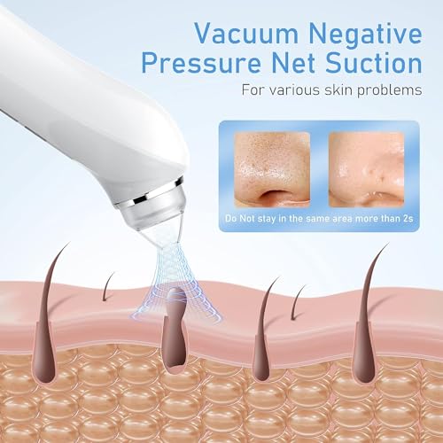 Blackhead Remover Vacuum with HD Camera & 6 Suction Heads