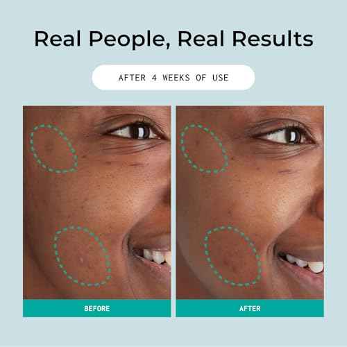 Liquid Brilliance Super Serum, Lightweight Hydrating Face Serum with Vitamin E & Amino Acids for Women, Moisturizer for All Skin Types, Daily Skin Care Routine, Vegan