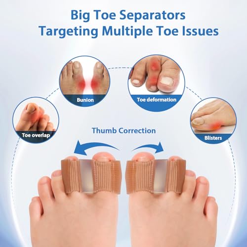NIXWAV 2 Pack Bunion Toe Separators L, 3-Point Gel Spacers with Dual Loops