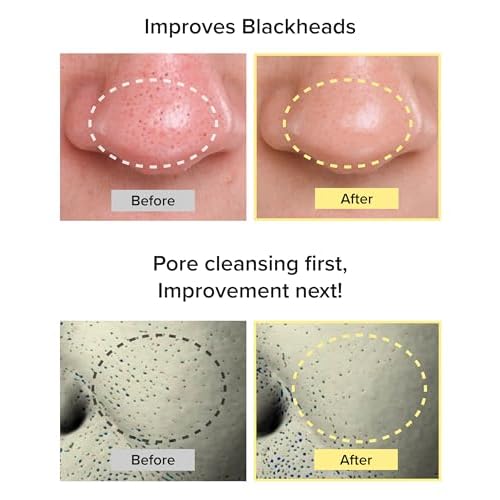 3W8L Deep Off & Fresh Cleansing Oil ? Fast emulsifying Korean pore care cleanser, gentle daily makeup & sunscreen remover with Jojoba & Centella, dissolves sebum & blackheads, hydrating fresh finish