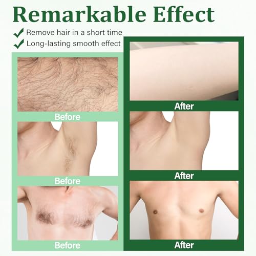 Wax Strips For Hair Removal, Waxing Kit For Women, Wax strips, Hypoallergenic, Facial Hair Removal for Women And Men, Waxing Hair Removeal Kit with 80 PCS + 4 Calming Oil Wipes(Green, Pack of 80)