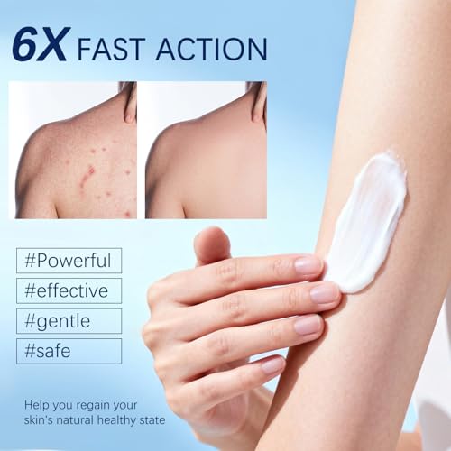 Folliculitis Cream for Scalp, Face & Body – 120g Soothing Relief