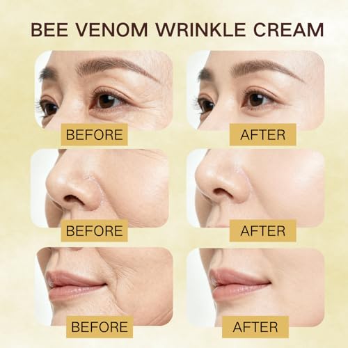 Bee Venom Skin Revitalizing Cream for Face & Body, Advanced Firming & Smoothing Formula, Natural Bee Venom Moisturizer for Fine Lines and Youthful Glow, 60g(4-Pcs)