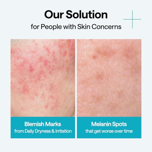Mediheal Wrapping Serum Mask [Madecassoside] Blemish Repair ? Intensive Calming & Repair Care with 98% Pure Madecassoside & CICA Complex ? Helps Calm Skin's Blemish Spots (10 Sheets)