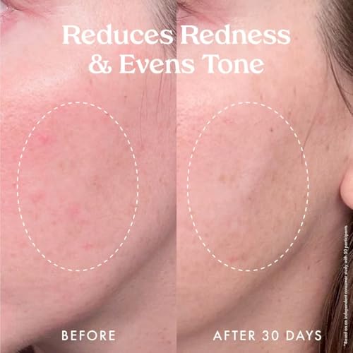 Kopari Star Bright Vitamin C Discoloration Correcting Serum with Kakadu Plum & Niacinamide, Brighter Complexion, Soothe & Diminish Dull Skin, 1.7oz