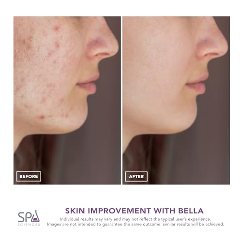 Spa Sciences - Bella Microdermabrasion Pore Extractor & Nano Mister